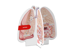 medizinische Broschüren, Patienteninformationen, Gesundheitsaufklärung, Diagnosematerialien, Therapieunterlagen, pharmazeutische Informationen, Arzt-Patienten-Kommunikation, Krankheitsmanagement, Behandlungspläne, Gesundheitsdienstleistungen, Außendienst, Pharma