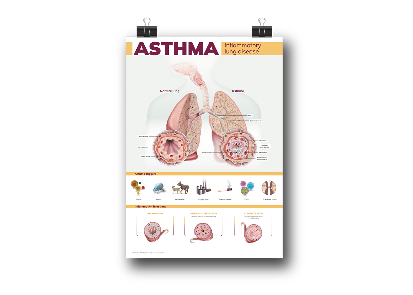 medizinische Broschüren, Patienteninformationen, Gesundheitsaufklärung, Diagnosematerialien, Therapieunterlagen, pharmazeutische Informationen, Arzt-Patienten-Kommunikation, Krankheitsmanagement, Behandlungspläne, Gesundheitsdienstleistungen, Außendienst, Pharma